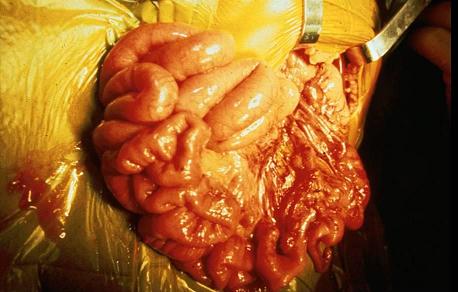 intestine.jpg